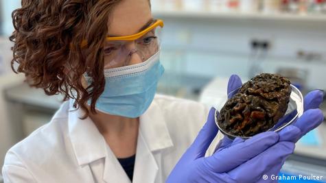 Hallan cerebros humanos que resisten la descomposición – DW – 20/03/2024