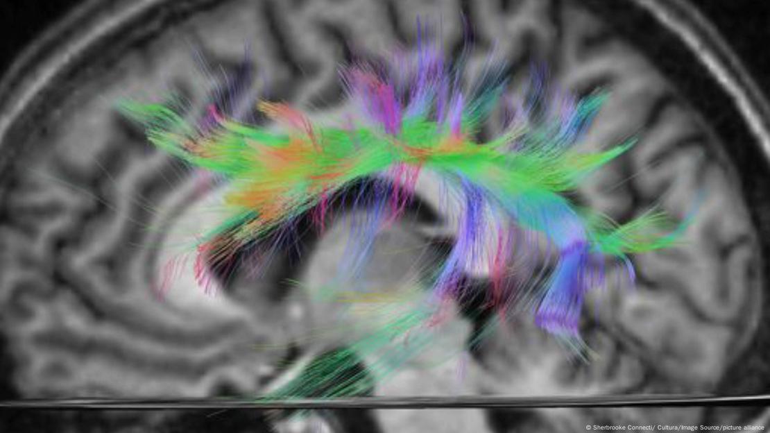 Radiografía de un cerebro. Radiografía de un cerebro.