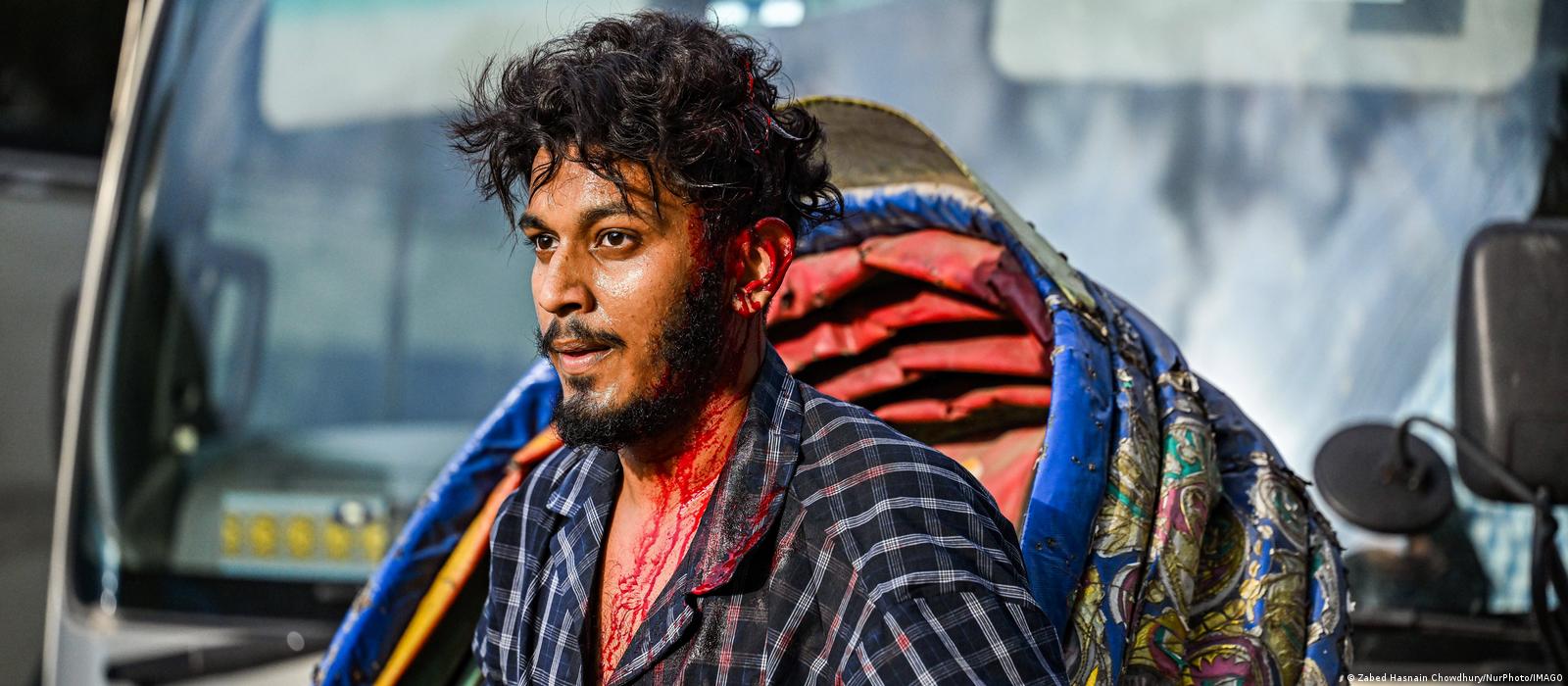 আহত শিক্ষার্থী