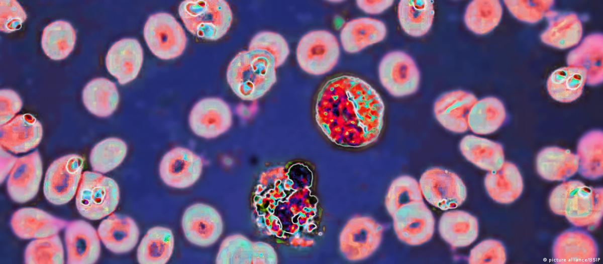 Esto sabemos de la misteriosa enfermedad en RDC – DW – 01/03/2025