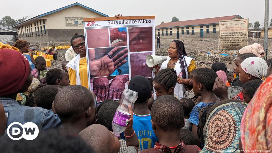 La RDC organise la risposte à l’épidémie du mpox