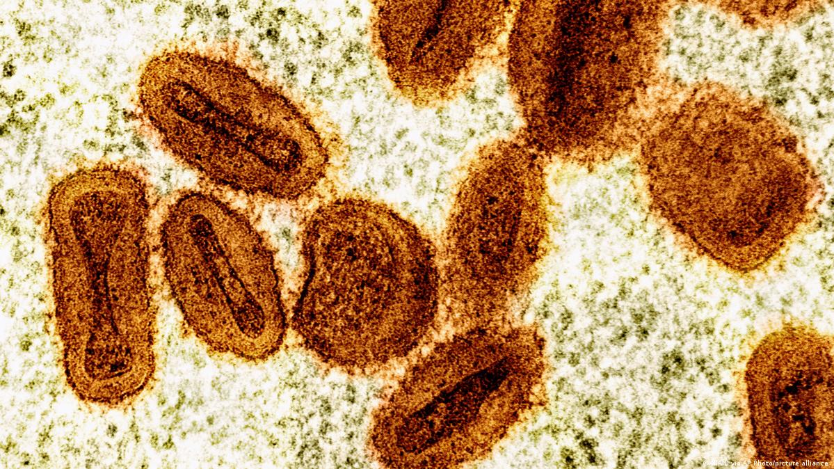 Germany detects first mpox variant Ib case