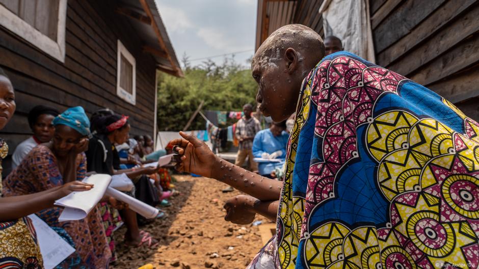 Congo: Displaced people caught between conflict and crisis - News Headlines