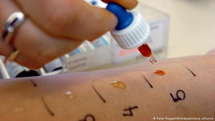 Morte de enfermeira em lua de mel acende alerta para alergia alimentar