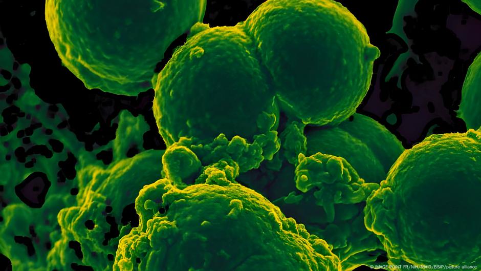 Staphylococcus aureus: otporne na više lekova i skoro nezaustavljive