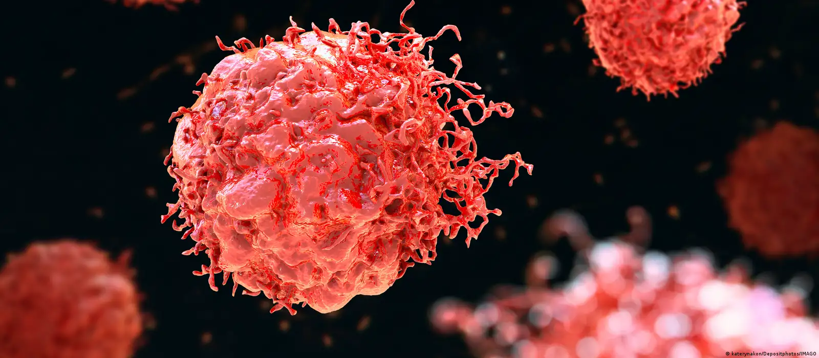 Actinomyces/Actinomicose | Concise Medical Knowledge, image size:1600x700