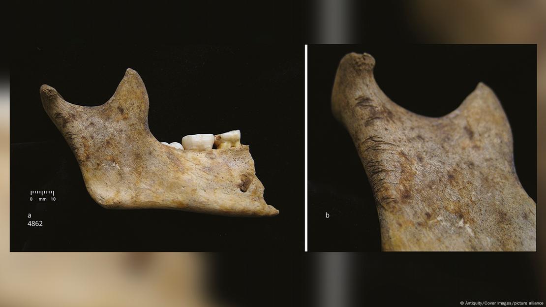 Restos de una mandíbula humana. Restos de una mandíbula humana.
