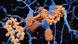 Gehirn mit Alzheimer-Krankheit: Die Illustration zeigt wie sich Amyloid-Plaques (orange) bilden und sich in "Nestern" um Nervenzellen (blau) legen Gehirn mit Alzheimer-Krankheit: Die Illustration zeigt wie sich Amyloid-Plaques (orange) bilden und sich in "Nestern" um Nervenzellen (blau) legen