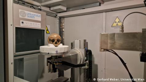 Estudio identifica cráneo atribuido a hermana de Cleopatra – DW – 13/01/2025