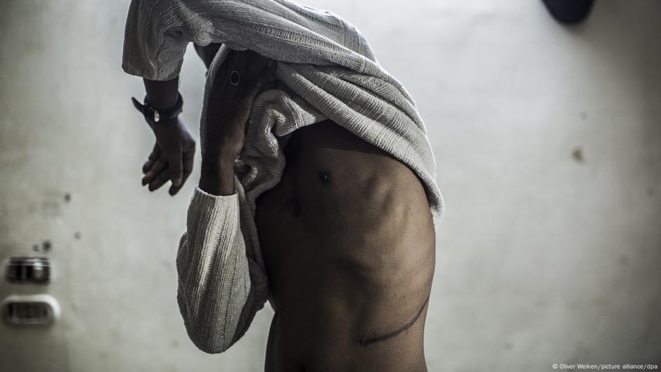Ghana's long battle to secure safe organ transplants DW 10/07/2025