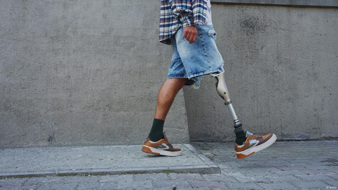 Un hombre con una prótesis en la pierna