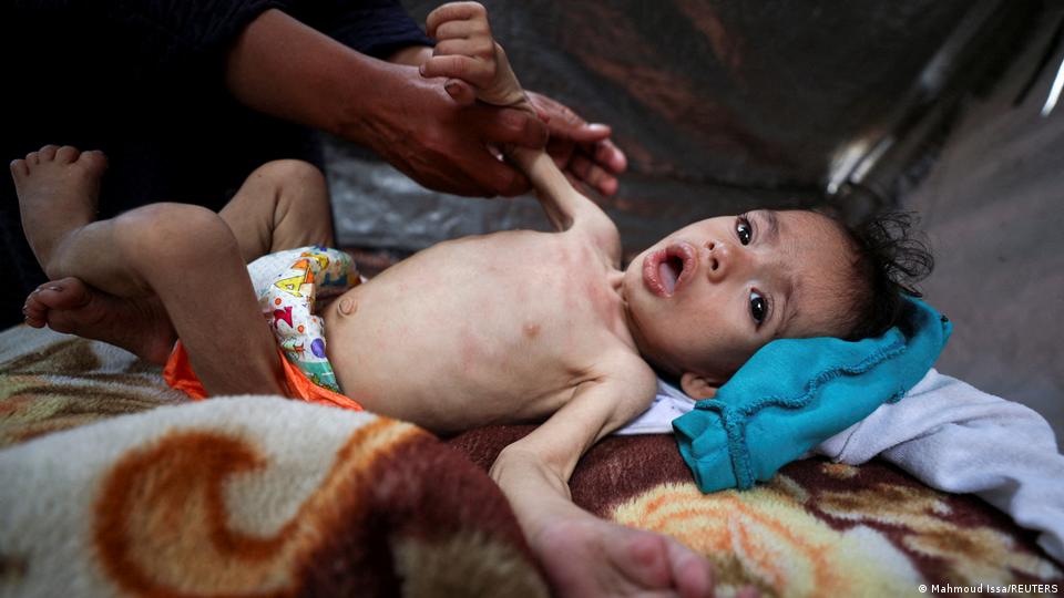 کودکی در نوار غزه 