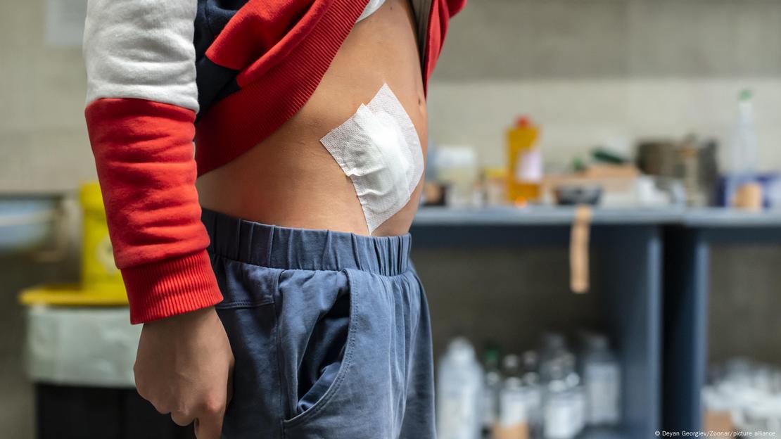 Cicatriz vendada en el abdomen de un joven tras una intervención quirúrgica. 