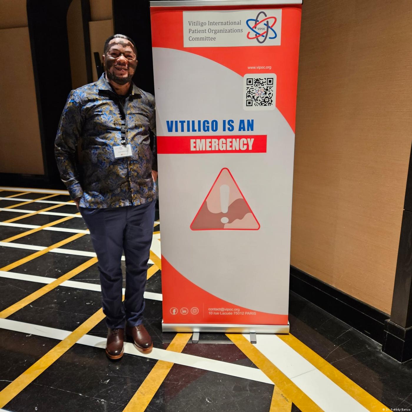 Sensibiliser pour changer le regard sur le vitiligo