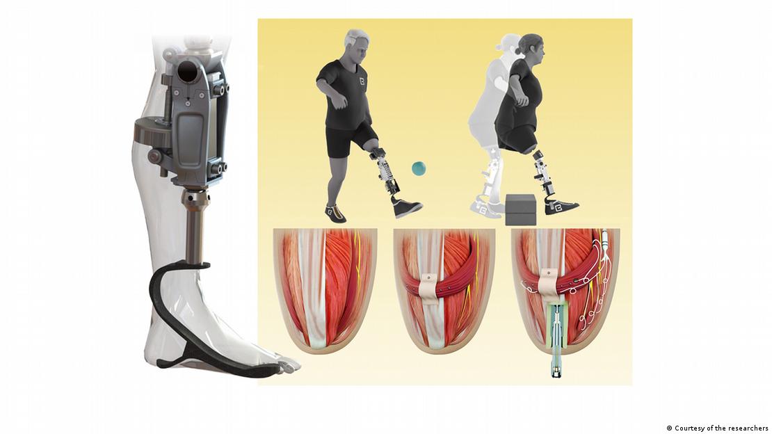 La retroalimentación sensorial guía al usuario en el control del movimiento y genera señales eléctricas útiles para operar la prótesis.