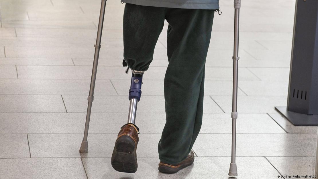 ایک شخص جس کی ایک ٹانگ گھٹنے سے نیچے مصنوعی ہے ایک شخص جس کی ایک ٹانگ گھٹنے سے نیچے مصنوعی ہے