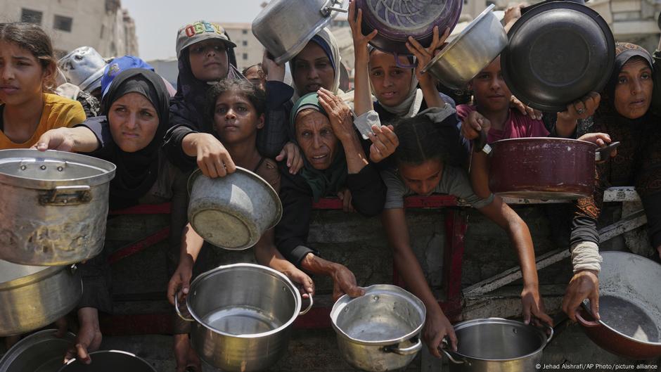 العفو الدولية تتهم إسرائيل بتنفيذ "حملة تجويع متعمدة" في غزة