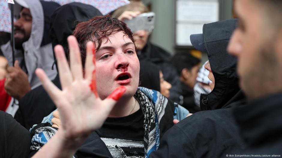 Germany: Ireland voices concern over Berlin police violence – DW – 08/30/2025