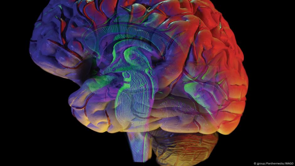 New 'brain atlases' may change fight against Alzheimer's, MS DW 11/05/2025