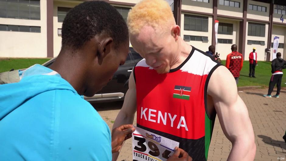 Kenyan para-sprinter with albinism breaks barriers Kenyan para-sprinter with albinism breaks barriers