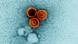 Los investigadores de Stanford Medicine desarrollaron un sistema de secuenciación de alta precisión para identificar células B infectadas por el virus de Epstein-Barr (foto). Los investigadores de Stanford Medicine desarrollaron un sistema de secuenciación de alta precisión para identificar células B infectadas por el virus de Epstein-Barr (foto).