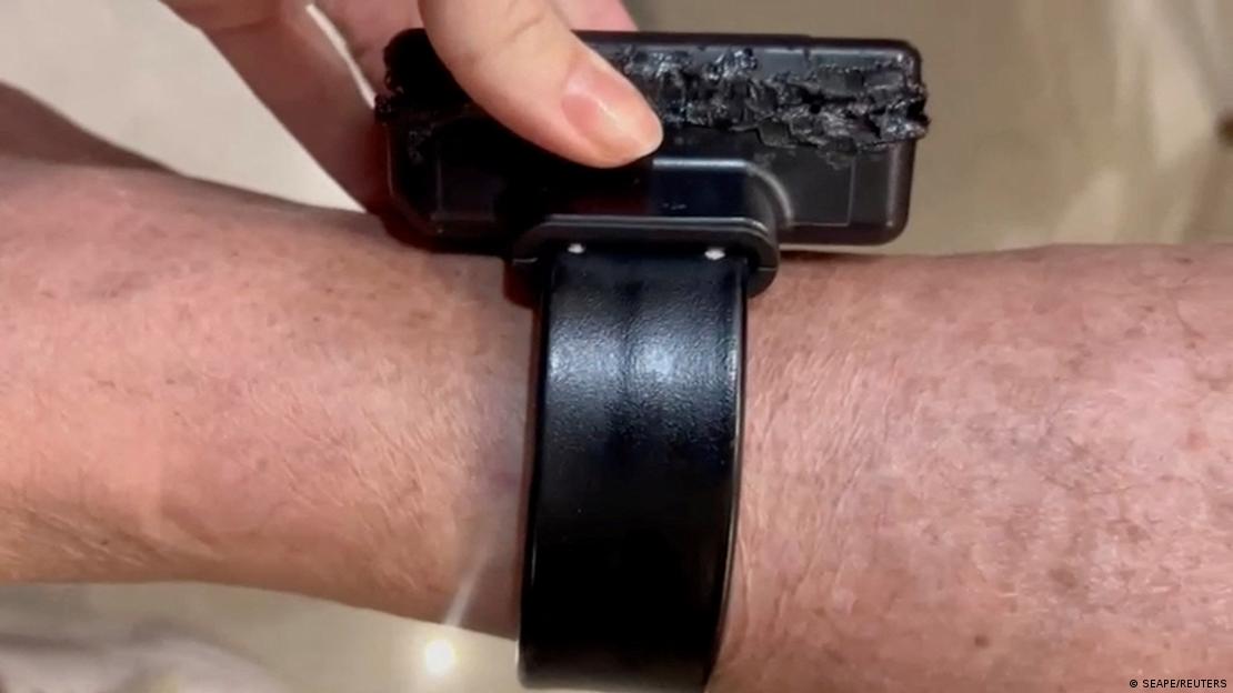 Bolsonaro'nun açmaya çalışırken hasar verdiği elektronik kelepçe.