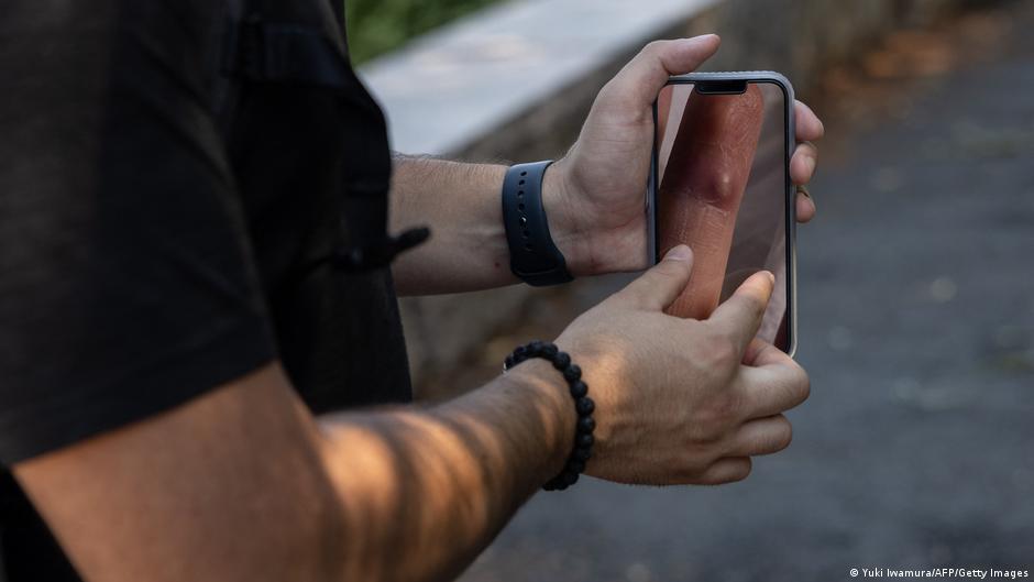 Mpox-die-Pandemie-ber-die-niemand-spricht