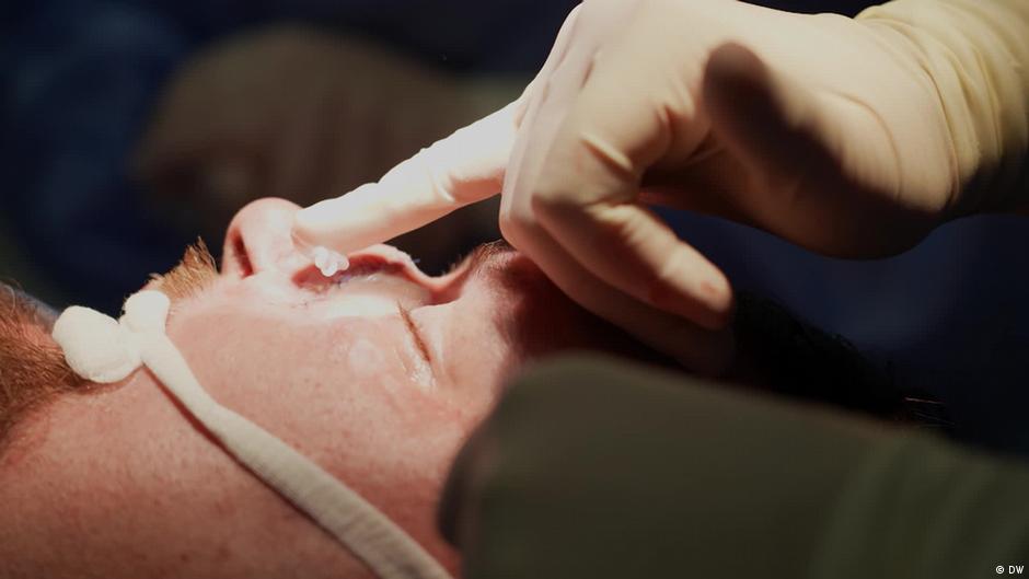 Facial reconstruction — step toward healing from war trauma