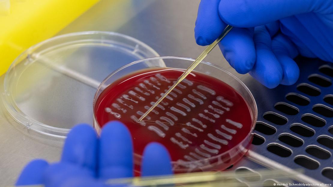 Manos con guantes ayules manipulando bacterias de Escherichia coli en un laboratorio.