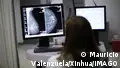 How AI is expanding breast cancer screening in Mexico 