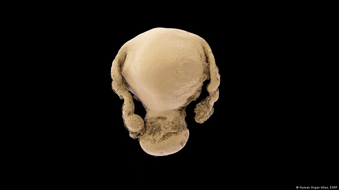 El método HiP-CT produjo imágenes 3D del útero humano que abrieron nuevas vías para comprender los trastornos ginecológicos y la anatomía reproductiva femenina. El método HiP-CT produjo imágenes 3D del útero humano que abrieron nuevas vías para comprender los trastornos ginecológicos y la anatomía reproductiva femenina.