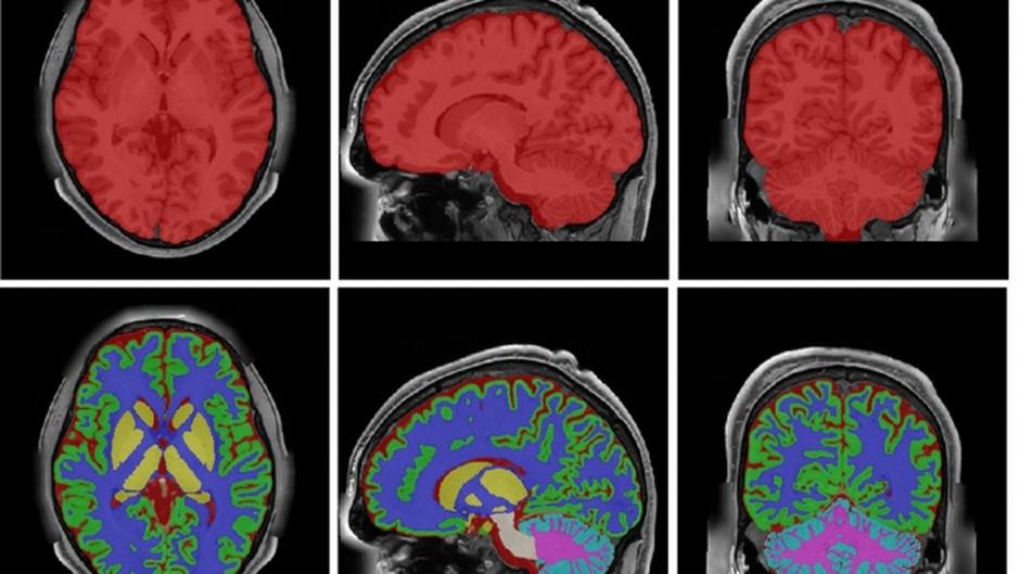 HoliAtlas: uno de los mapas del cerebro humano más detallados del mundo