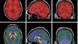 Seis imagenes del cerebro de: Manjón, J.V., Morell-Ortega, S., Ruiz-Perez, M. et al. Ultra-high resolution multimodal MRI densely labelled holistic structural brain atlas. Sci Rep 16, 9457 (2026). https://doi.org/10.1038/s41598-026-40186-2 Seis imagenes del cerebro de: Manjón, J.V., Morell-Ortega, S., Ruiz-Perez, M. et al. Ultra-high resolution multimodal MRI densely labelled holistic structural brain atlas. Sci Rep 16, 9457 (2026). https://doi.org/10.1038/s41598-026-40186-2