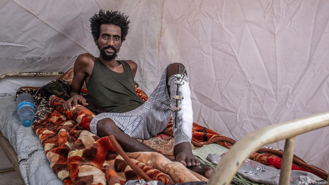 Homem deitado em cama, com uma das pernas ferida