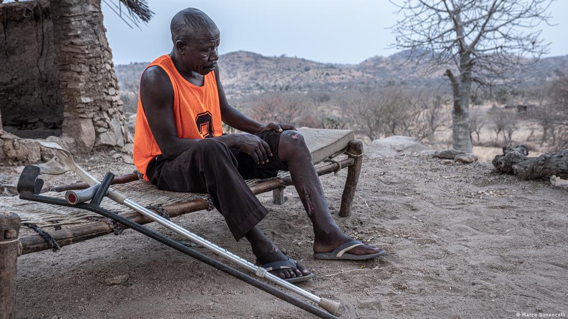 Hassan Kokos sentado em cama de madeira, ao ar livre, levanta a perna da calça para mostrar cicatrizes