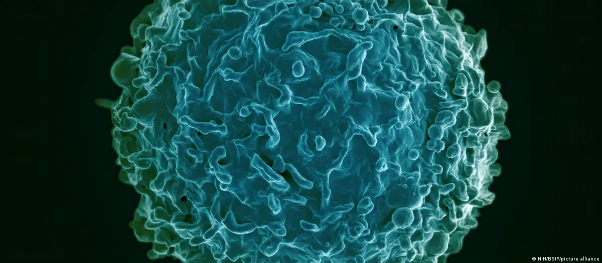 La terapia CAR-T eliminó las células B desreguladas vinculadas a las tres enfermedades autoinmunes de la paciente.Imagen: NIH/BSIP/picture alliance