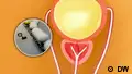 The prostate: A small, peculiar organ that plays a big role