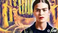 Art born out of pain: Frida Kahlo