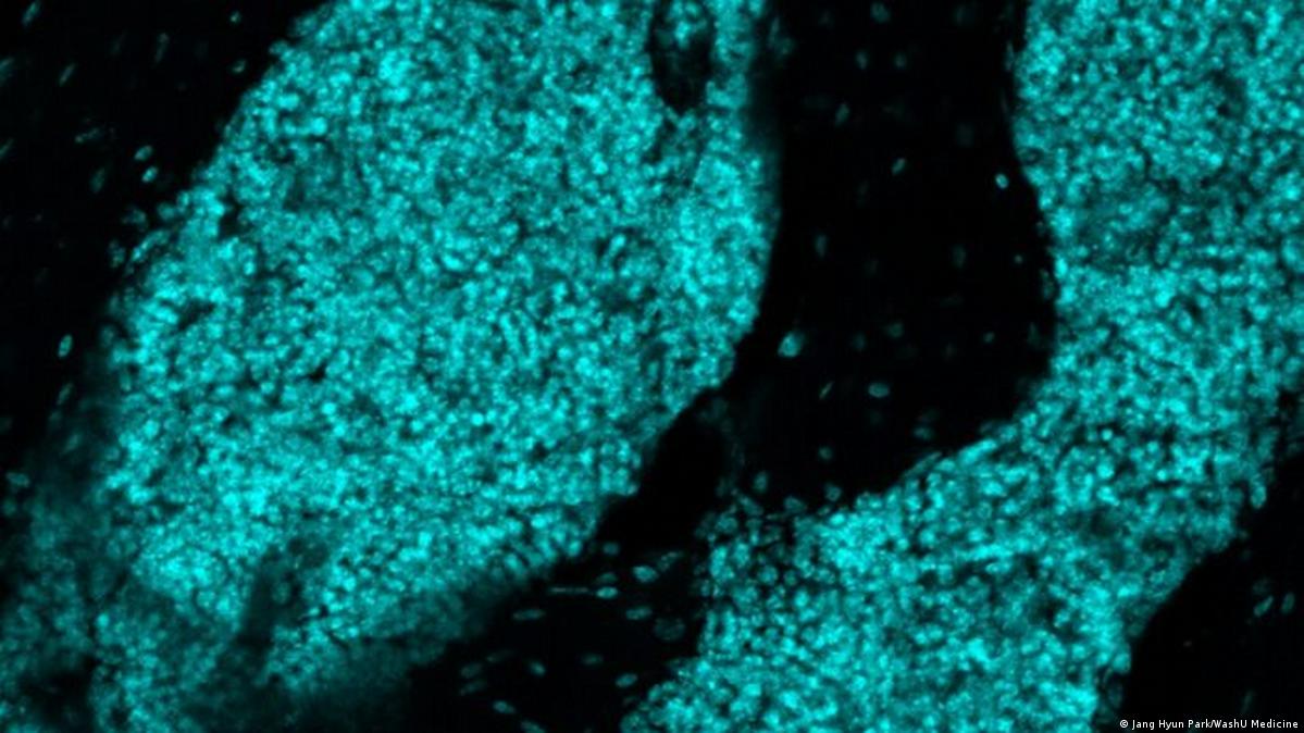WashU Medicine tədqiqatçıları siçanların kəllə sümüyü iliyi içində limfa düyününə bənzər strukturlar (siyan rəngində göstərilib) aşkar ediblər. Şəkil: Jang Hyun Park/WashU Medicine