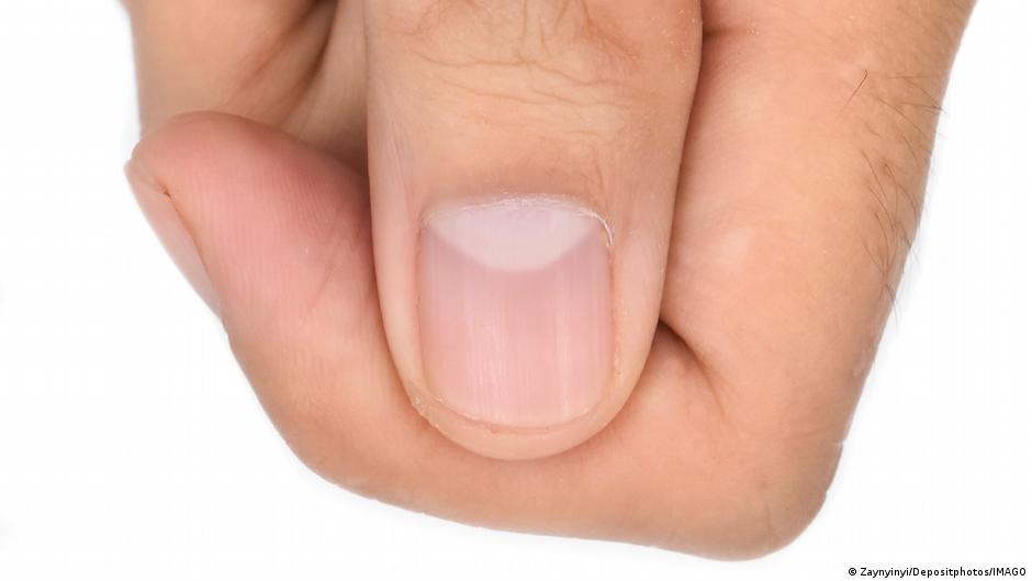 Este sutil cambio en tus uñas puede esconder un problema de salud que aún no ha dado síntomas