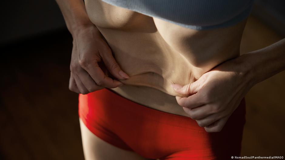 Las tasas de anorexia y bulimia se disparan más de un 70 % desde 1990 y todo apunta a que seguirán aumentando