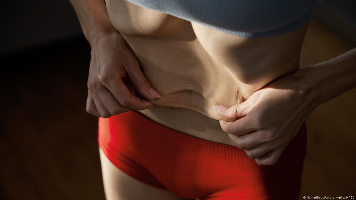Las tasas de anorexia y bulimia se disparan más de un 70 % desde 1990 y todo apunta a que seguirán aumentando