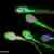 تصويرى از اسپرم انسانى زير نور ميكروسكوپ فلورسانس، رنگهاى مختلف نمايشگر پروتئين‌هاى متفاوتند.